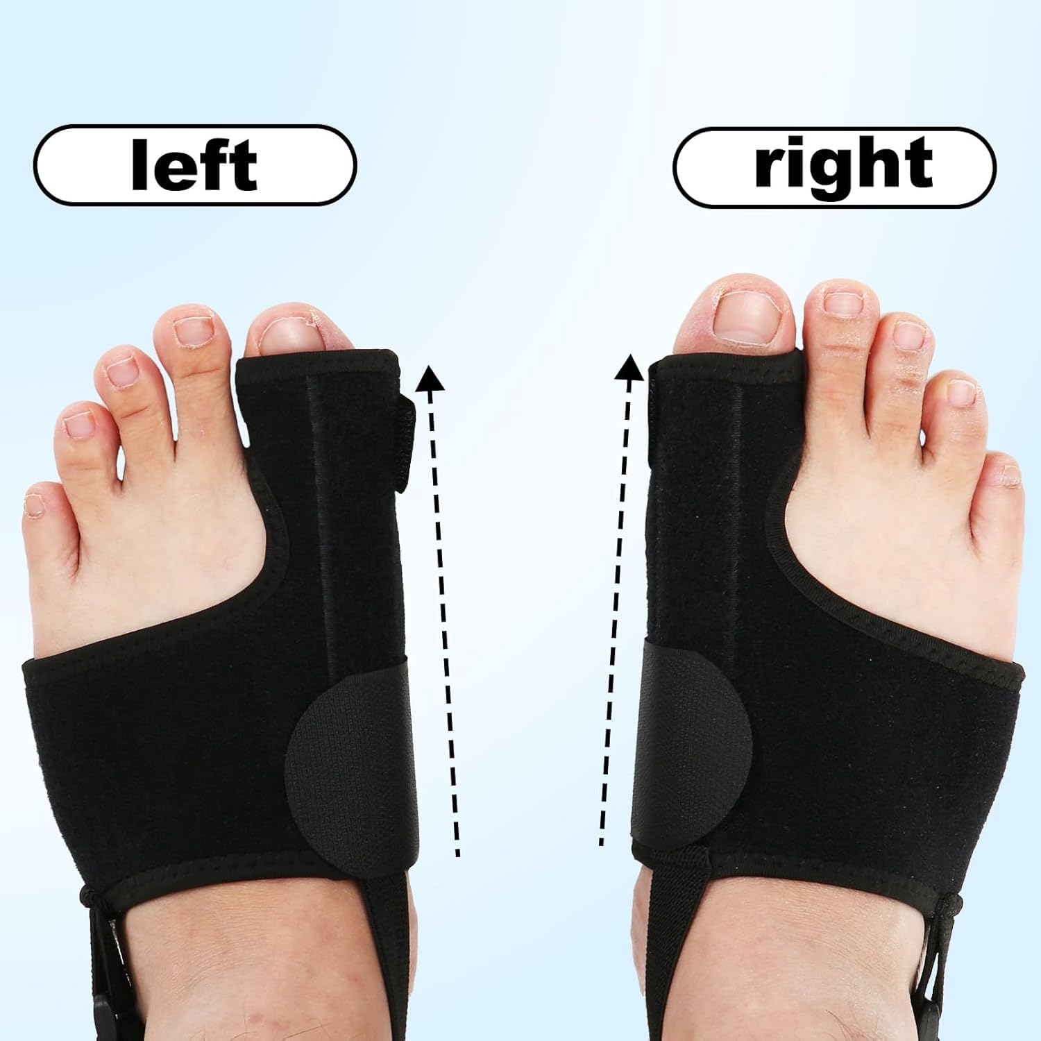 Big Toe Straightener Brace Separators with Metal Plates, 2Pcs Big Toe Straightener Bunion Splint Bunion Pads, Big Toe Straightener Bunion Corrector for Women and Men image number 4