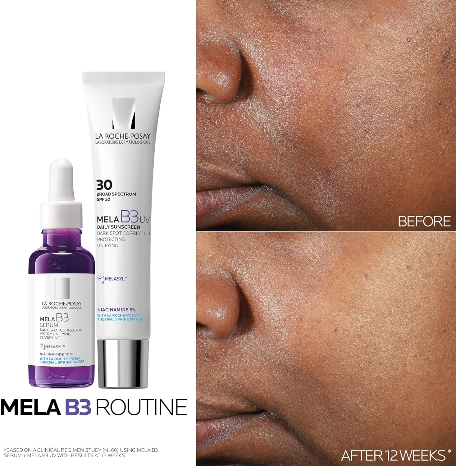 La Roche-Posay Mela B3 Dark Spot Correcting Serum Face Serum 50 Ml image number 6