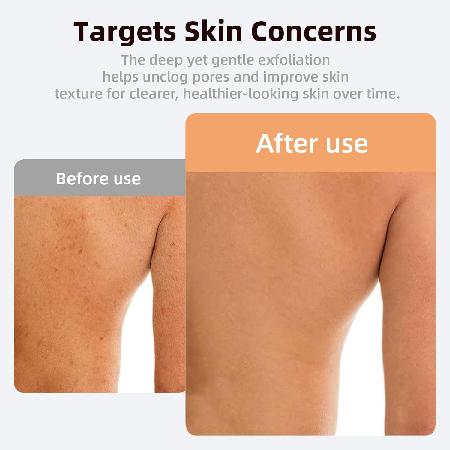 Suytvenxau Exfoliating Gloves - Body Scrub Gloves for Removing Dead Skin - Korean-Style Exfoliating Towels for Women and Men - Perfect Preparation before Tanning - Black Pairs image number 1