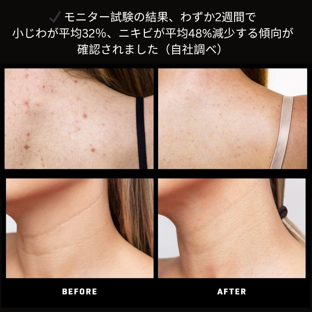 FAQ 211 Wearable Silicone Anti-Aging NIR + 7 LED Light Therapy Neck & D&eacute;collet&eacute; Mask - Luxury Skincare for Lines & Wrinkles - Wireless & Lightweight - Flexible-Fit & Full Coverage - Beauty Skin Care image number 3