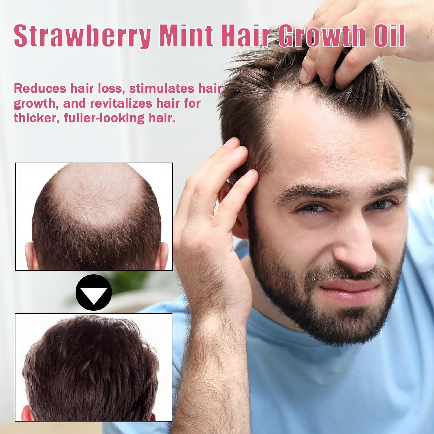 GTWEPZ 2Pcs Strawberry Mint Growth Oil,Strawberry Mint Hair Growth Oil,Organic Hair Growth Serum for Thin Hair Dry Damaged Hair, Beige image number 3