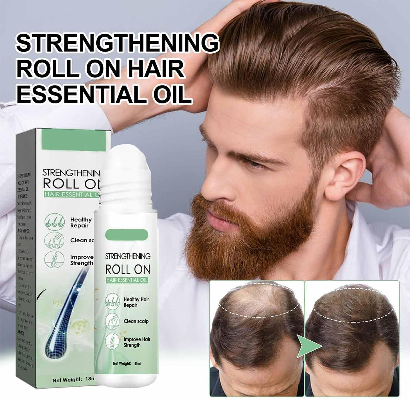Renewhairx - Renew Hair X Roll-On Hair,Hair and Beard Regrowth,Roll-On Hair Growth Oil,Hair Growth Serum,Anti-Hair Loss Essential Oil,Hair and Beard Regrowth Roll on Serum for Women Men image number 4