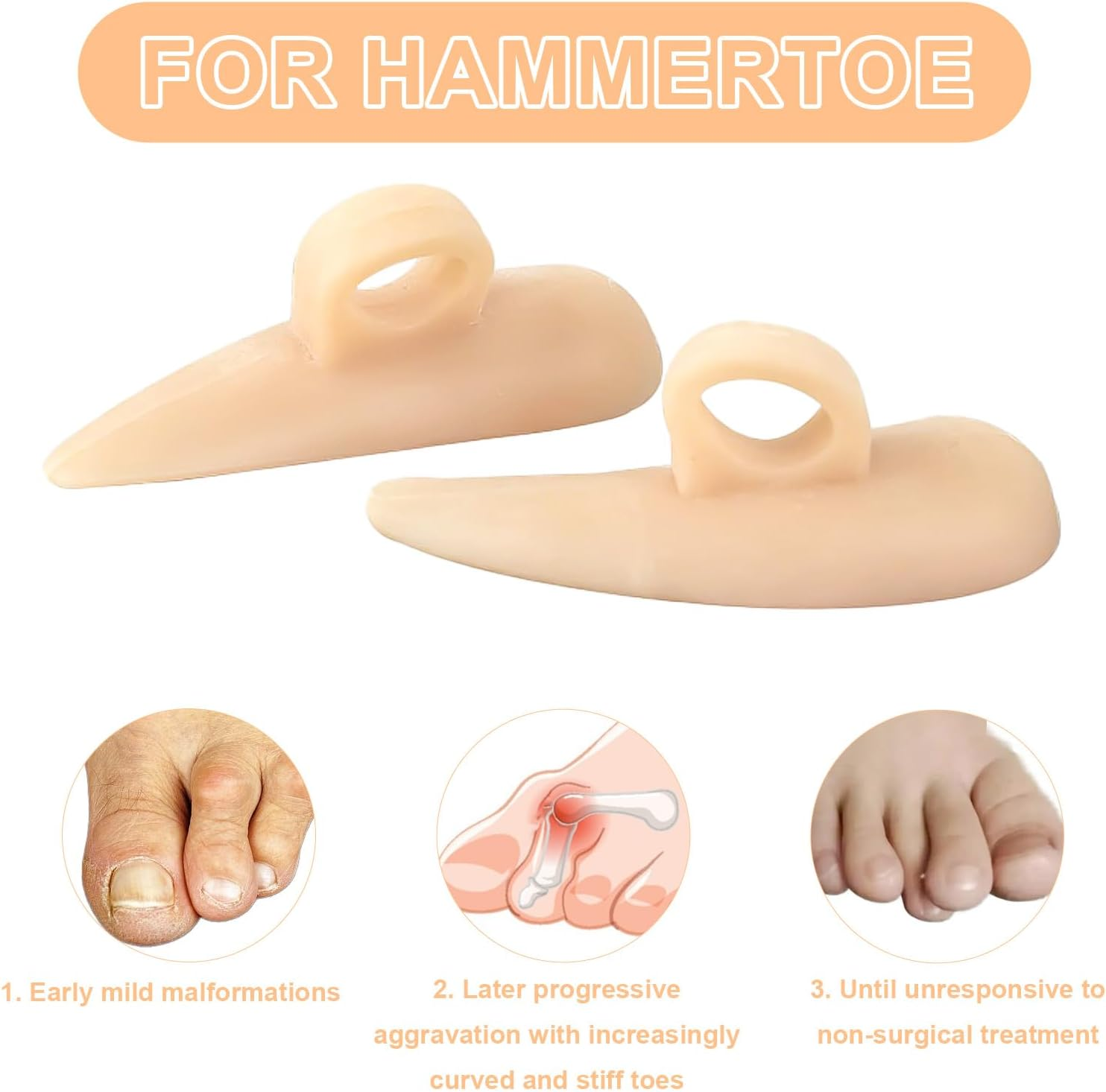 6 Pieces Hammer Toe Cushion & Toe Separators - Gel Pads Corrector & Straightener for Curled, Curved, Claw & Mallet Toe Relief - Right & Left Gel Support Crest Cushion with Toe Spacers (Beige) image number 2