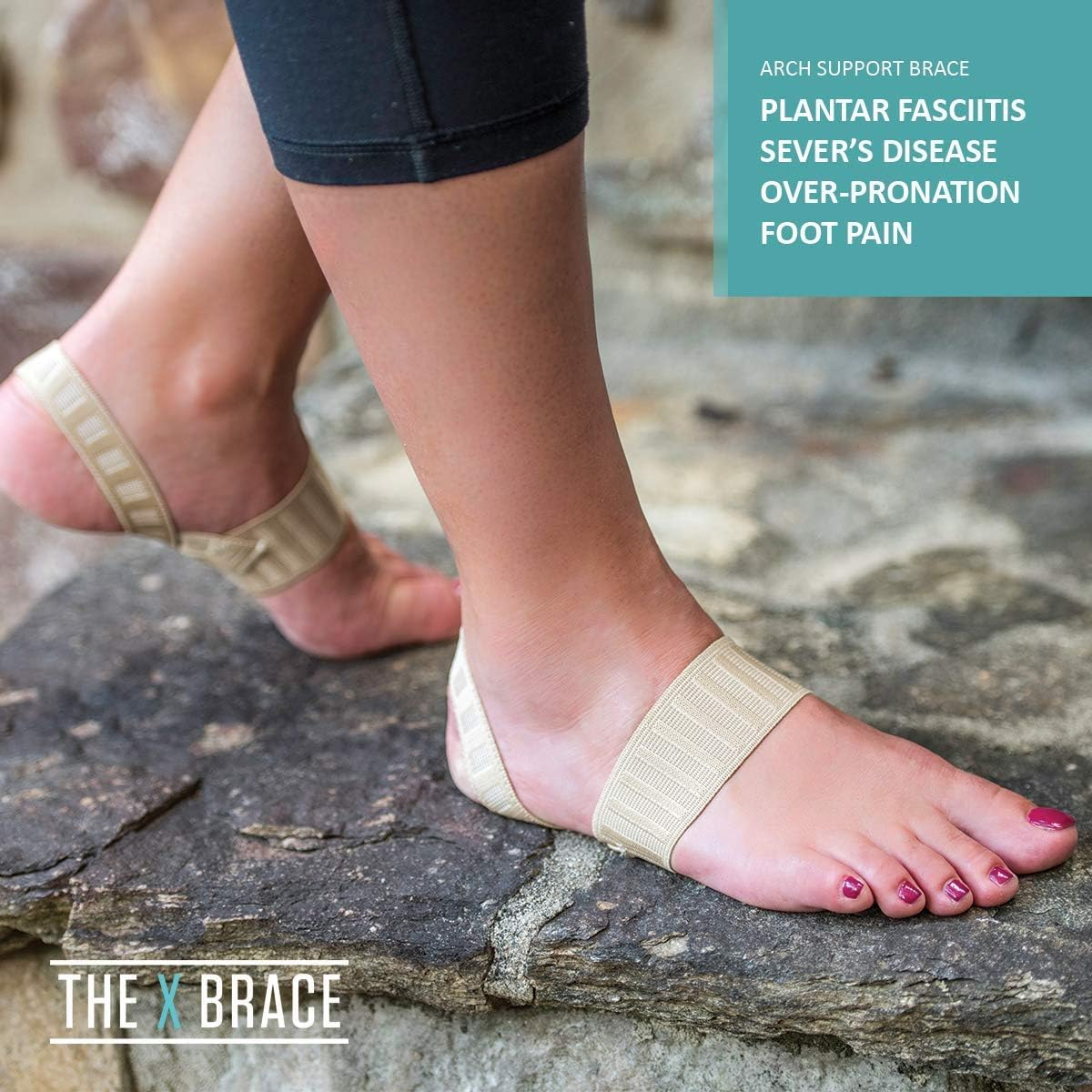 X Brace (Pair) &ndash; Arch Support Brace and Compression for Sever&rsquo;S Disease, Plantar Fasciitis, Flat Feet, Fallen Arches, Over-Pronation and Heel Pain, Logo Free (S) image number 3