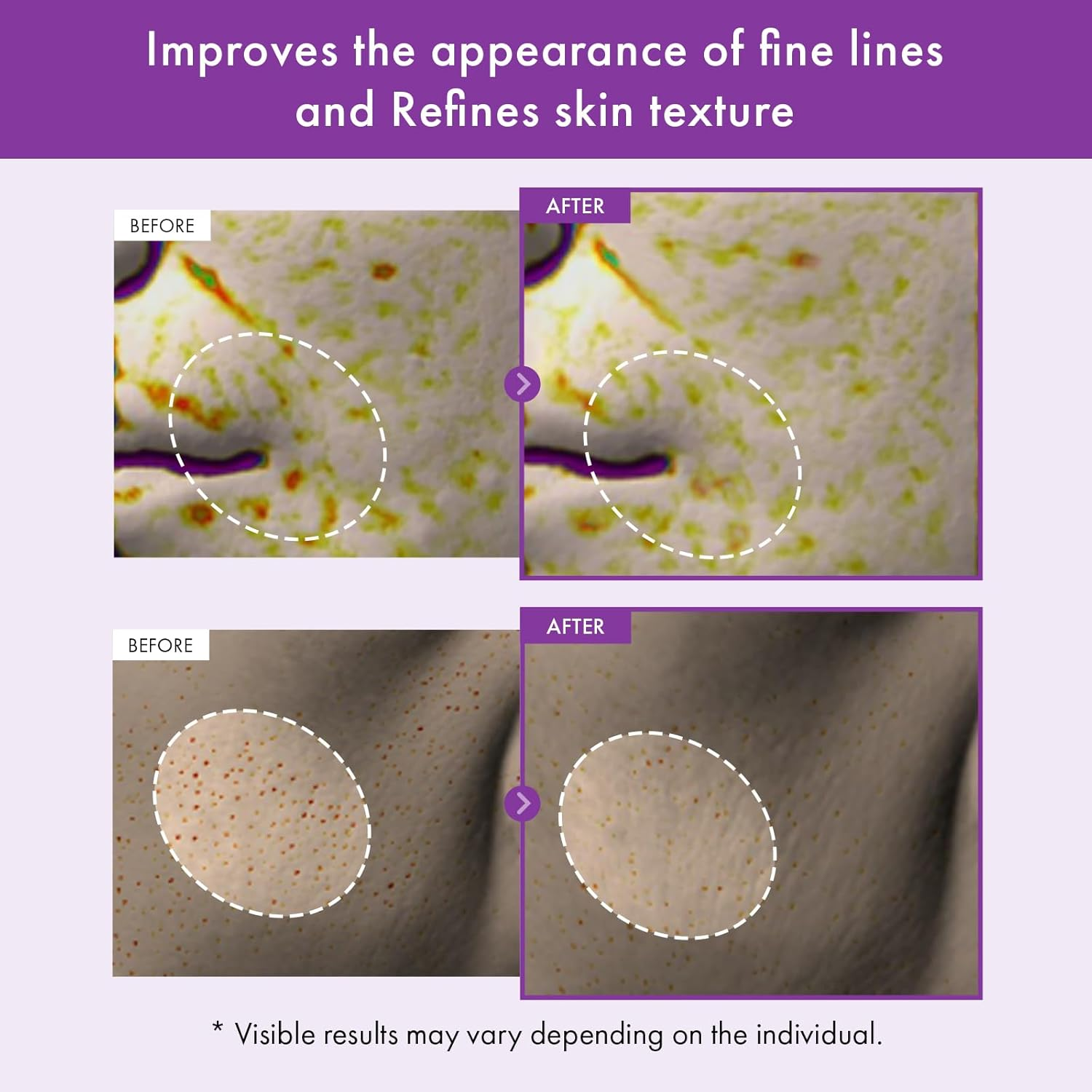 TOSOWOONG Real Retinol 0.1% Night Cream, Face Moisturizer with Retinol, Bakuchiol | Korean Skincare for Face & Neck, 50Ml / 1.69 Fl. Oz.