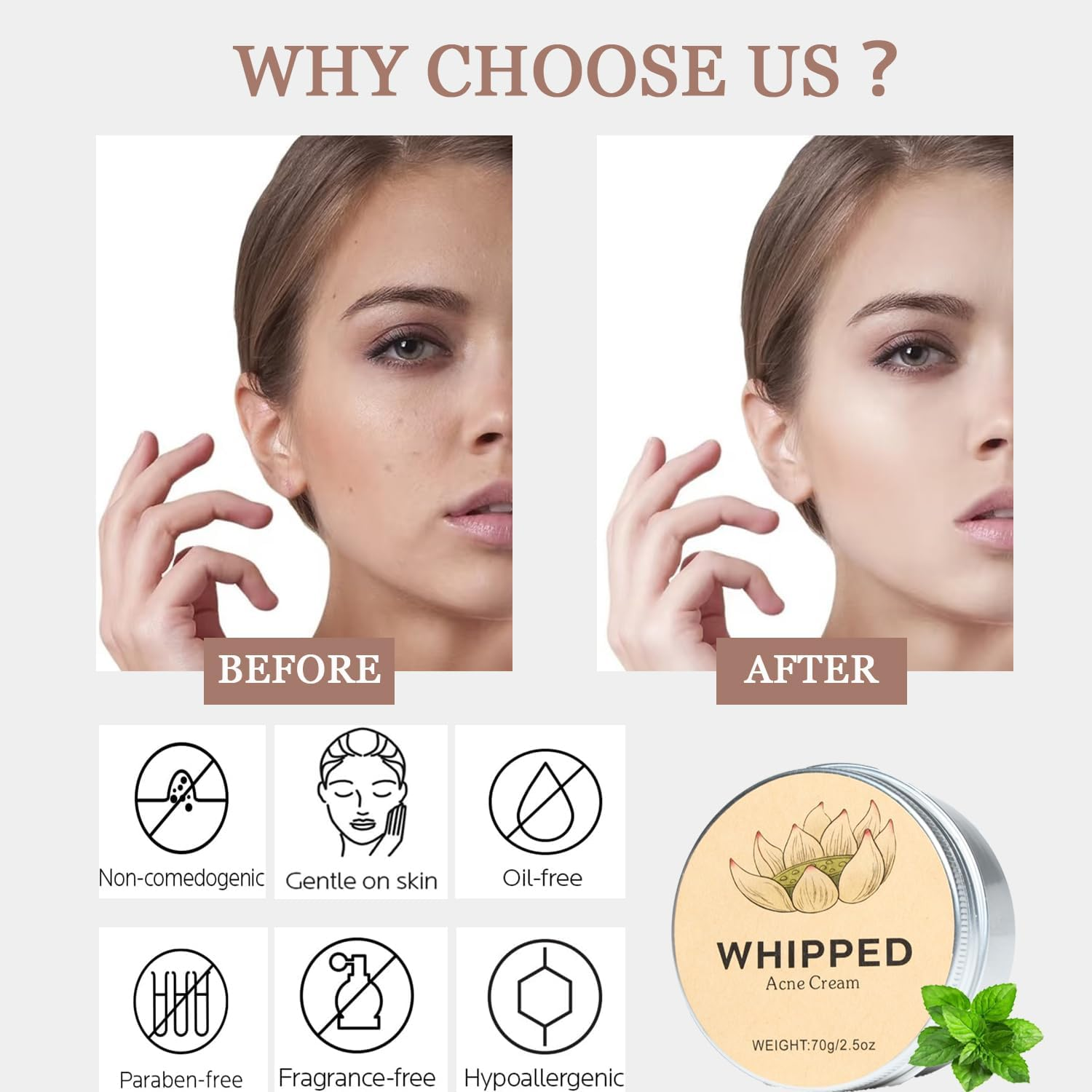 Norse Organics Acne, Norse Organic Acne and Redness Relief Balm, Norse Organics Acne & Redness Killer, Acne Remove Skin Care Set, Face Balm for Teens and Adults(70G/2.5Oz) image number 5