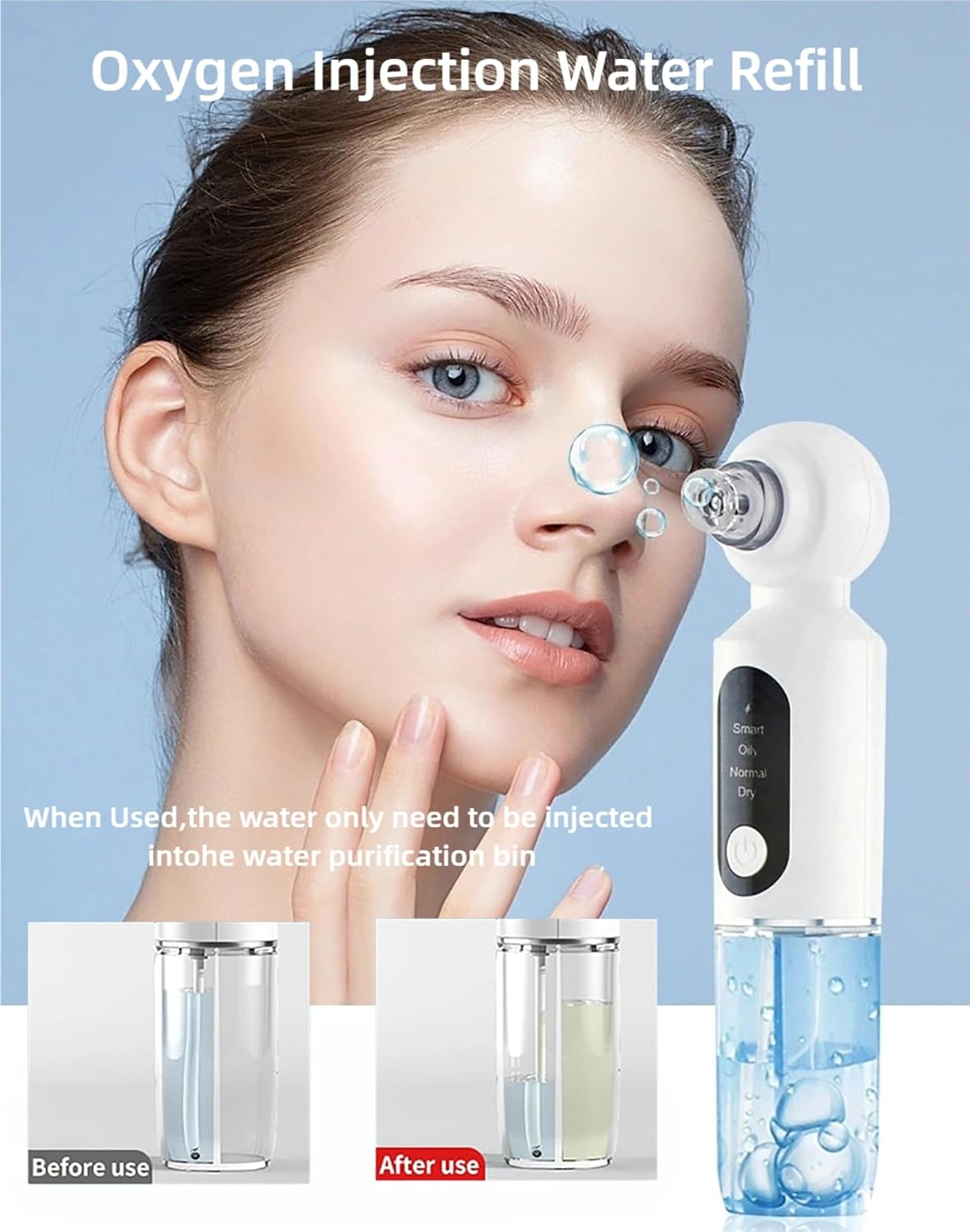 Blackhead Remover, Black Heads Remover with Hot Compress, 4 Adjustments Pore Vacuum Cleaner, Blackhead Vacuum with 6 Suction Cups, USB Charge, Pore Cleaner for Men & Women. image number 4