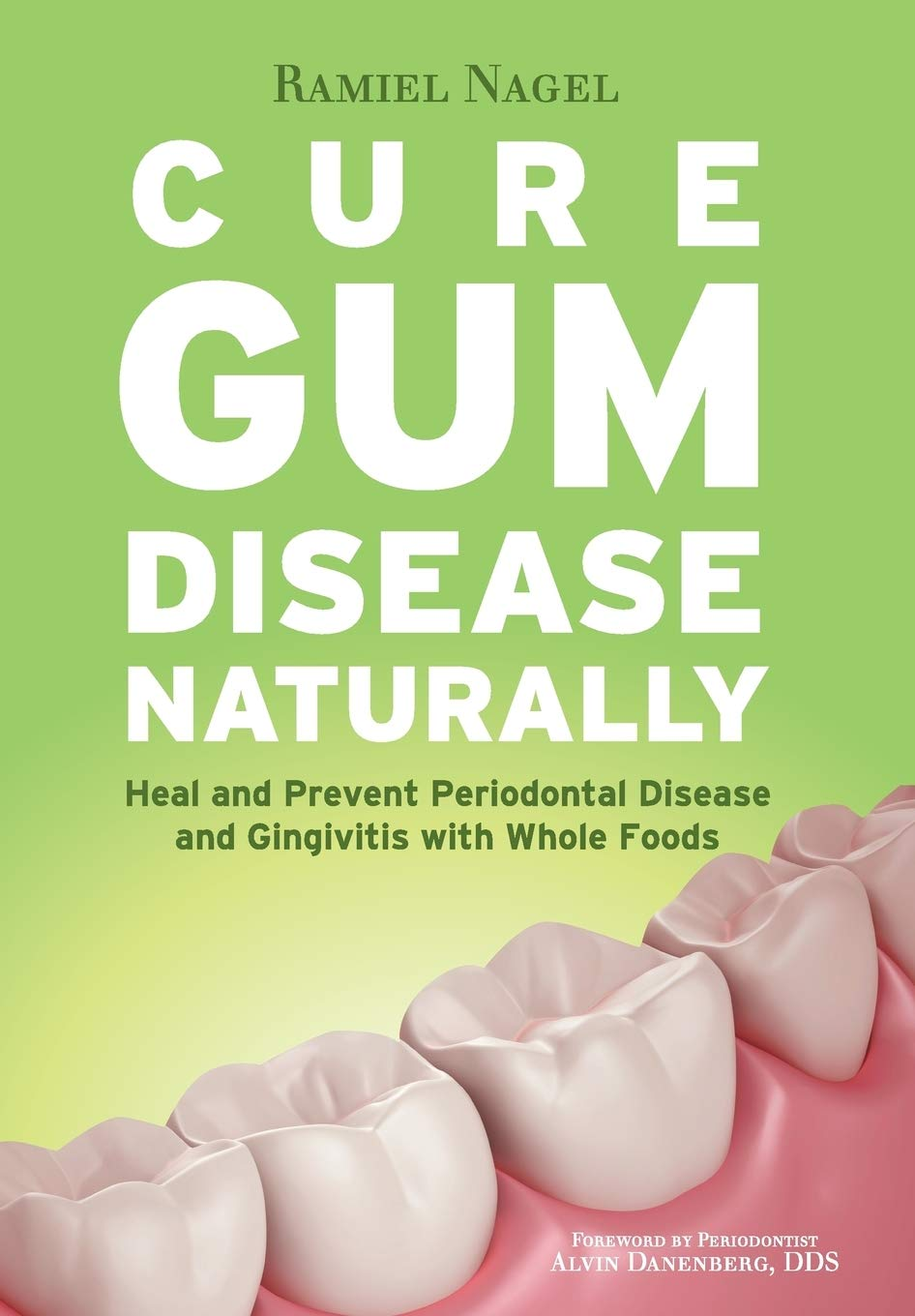 Cure Gum Disease Naturally: Heal Gingivitis and Periodontal Disease with Whole Foods image number 2