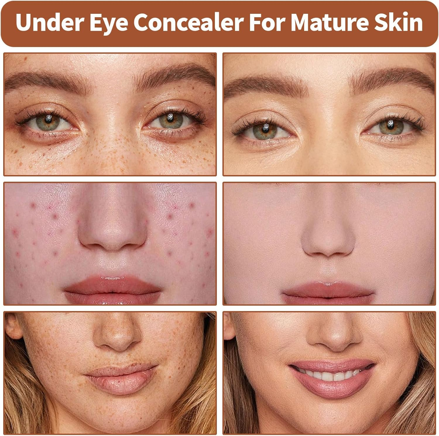 Concealer, Color Correcting Concealer Full Coverage, Used to Improve Uneven Skin Tone, Dullness, and Other Issues Etc(140/Dark Skin Tone)