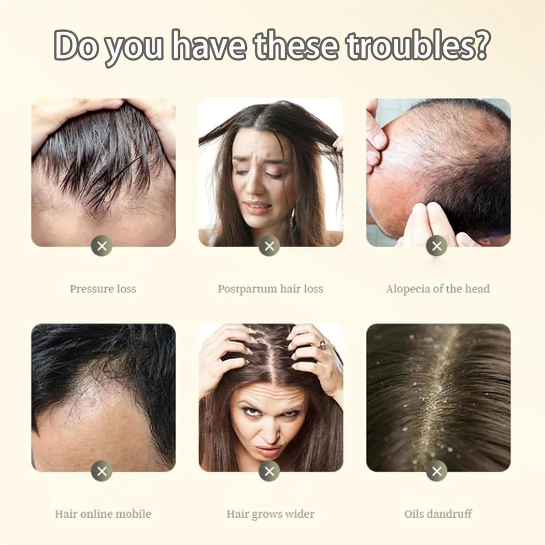 Polygonum Multiflorum Ginger Plant Extract Shampoo, 240Ml Polygonum Multiflorum Oil Control Anti-Dandruff Shampoo, Plant Extract Hair Growth Shampoo image number 4