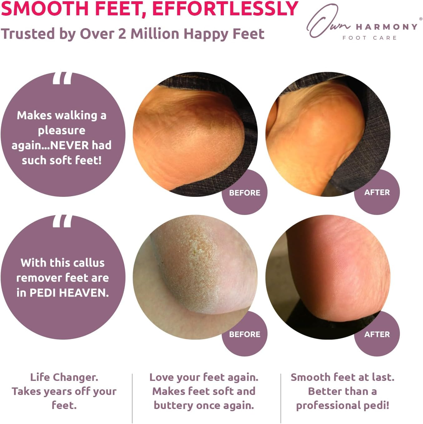 Electric Foot File, Rechargeable Foot Callus Remover: Professional Spa Pedicure Kit and Foot Scrubber Tools, Cracked Heel Repair Feet Care by Own Harmony - Best for Dry, Dead, Hard Skin - 3 Rollers image number 6