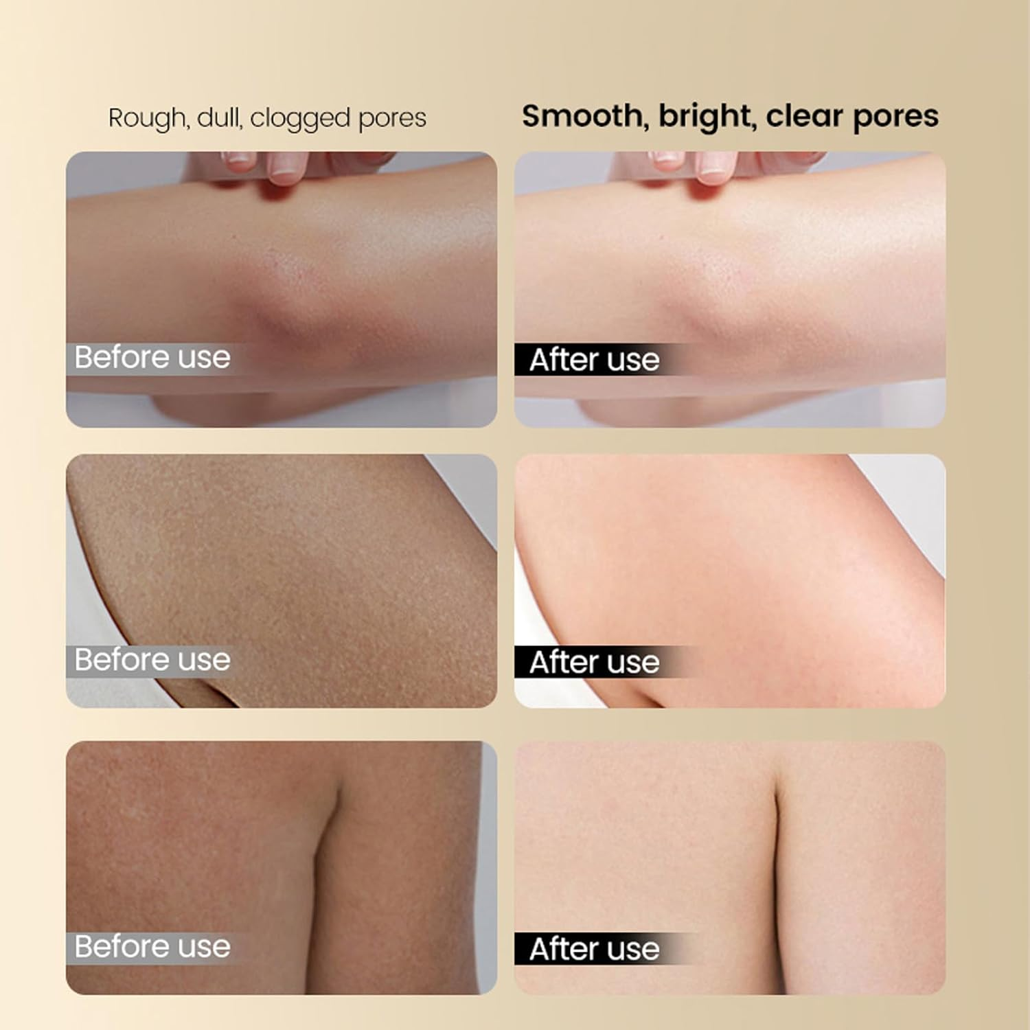 Glycolic Acid Face Stick 75G, Exfoliating Toner Stick for Face & Body, AHA Chemical Exfoliant for Blackheads, Dark Spots & Wrinkles, Gently Smooth & Renew Skin image number 1