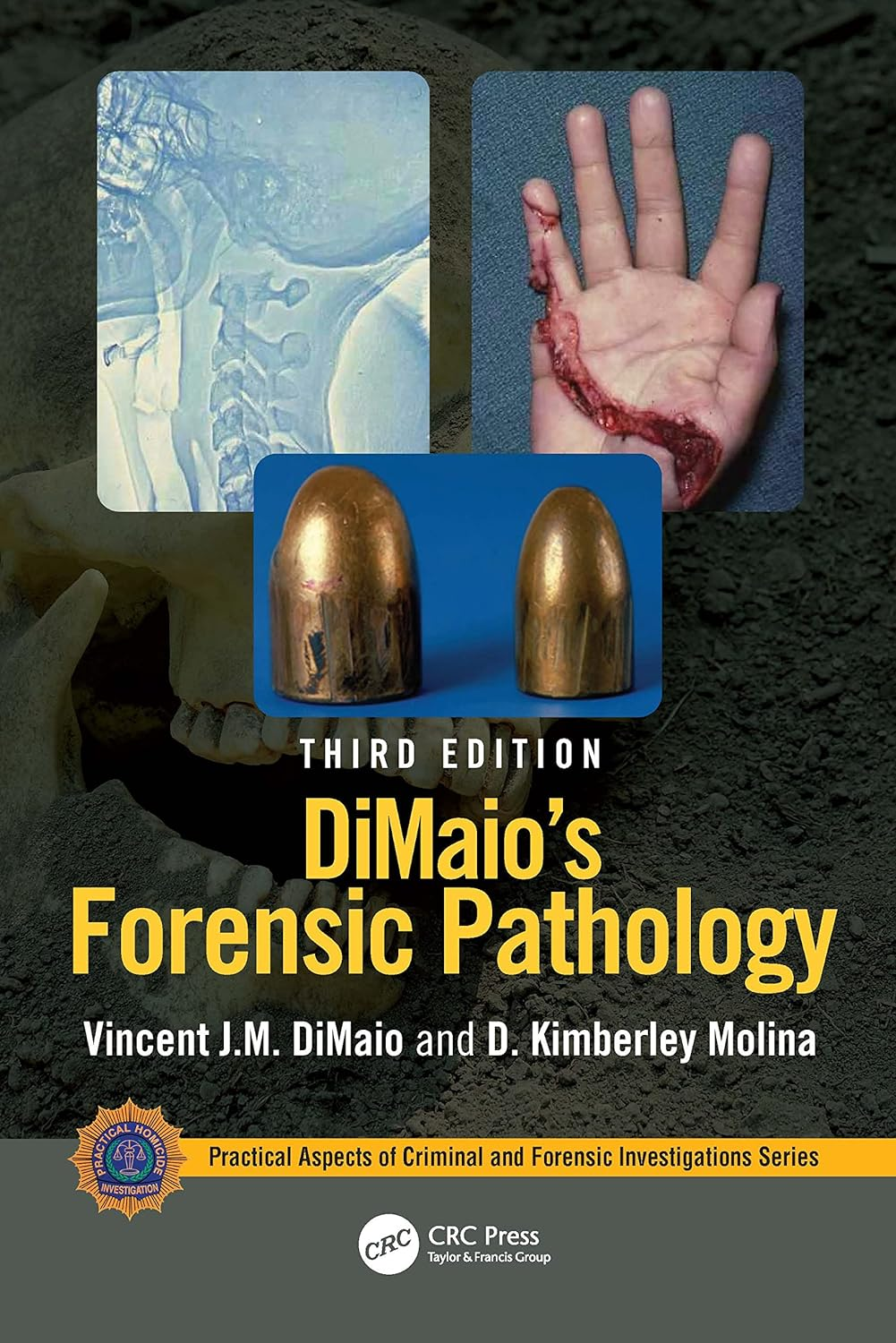 Dimaio'S Forensic Pathology