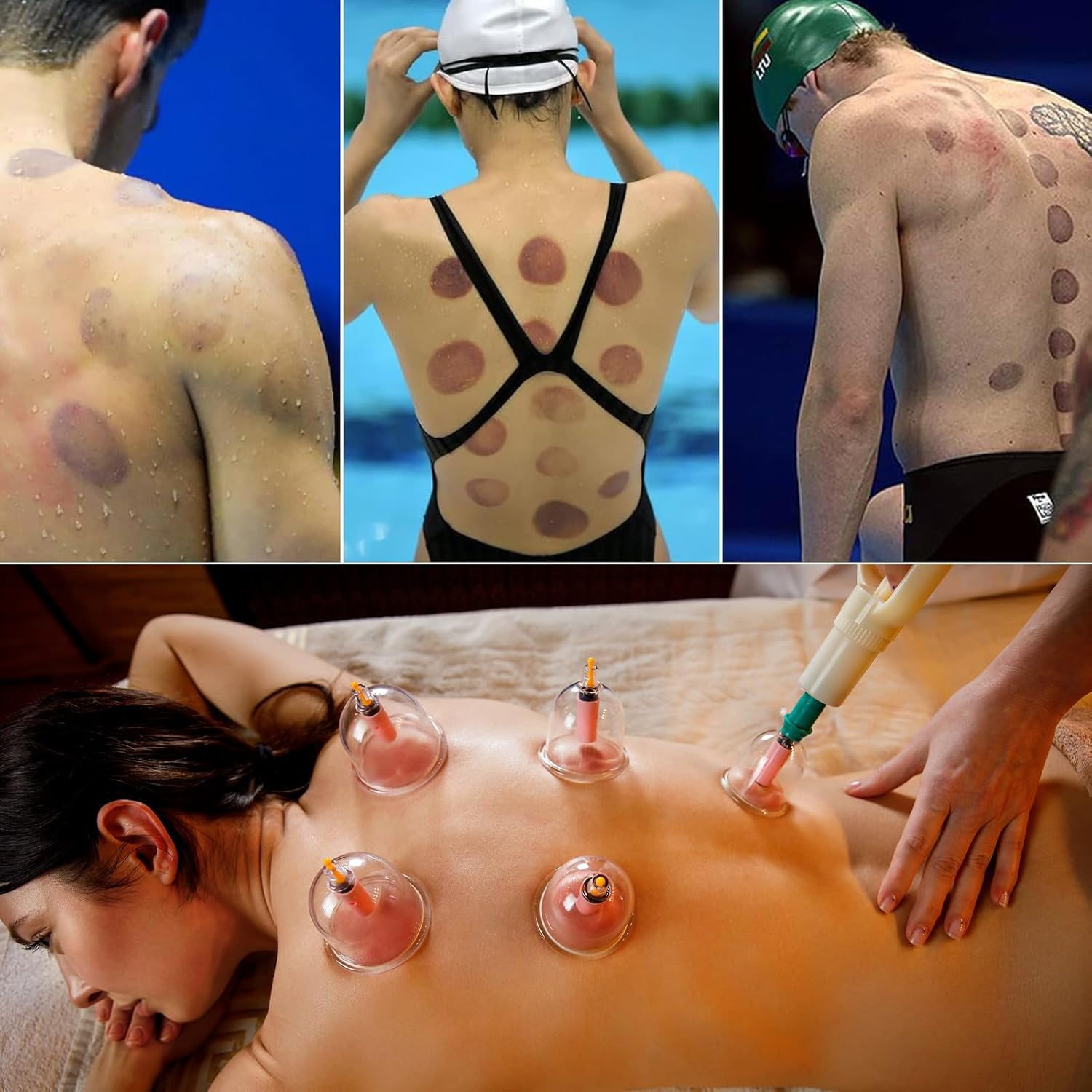 32PCS Cupping Set,Vacuum Therapy Cupping Suction Massager Kit with Pump,Chinese Professional Acupoint Cupping Therapy Hijama for Cellulite Reduction Muscle Pain Relief image number 2