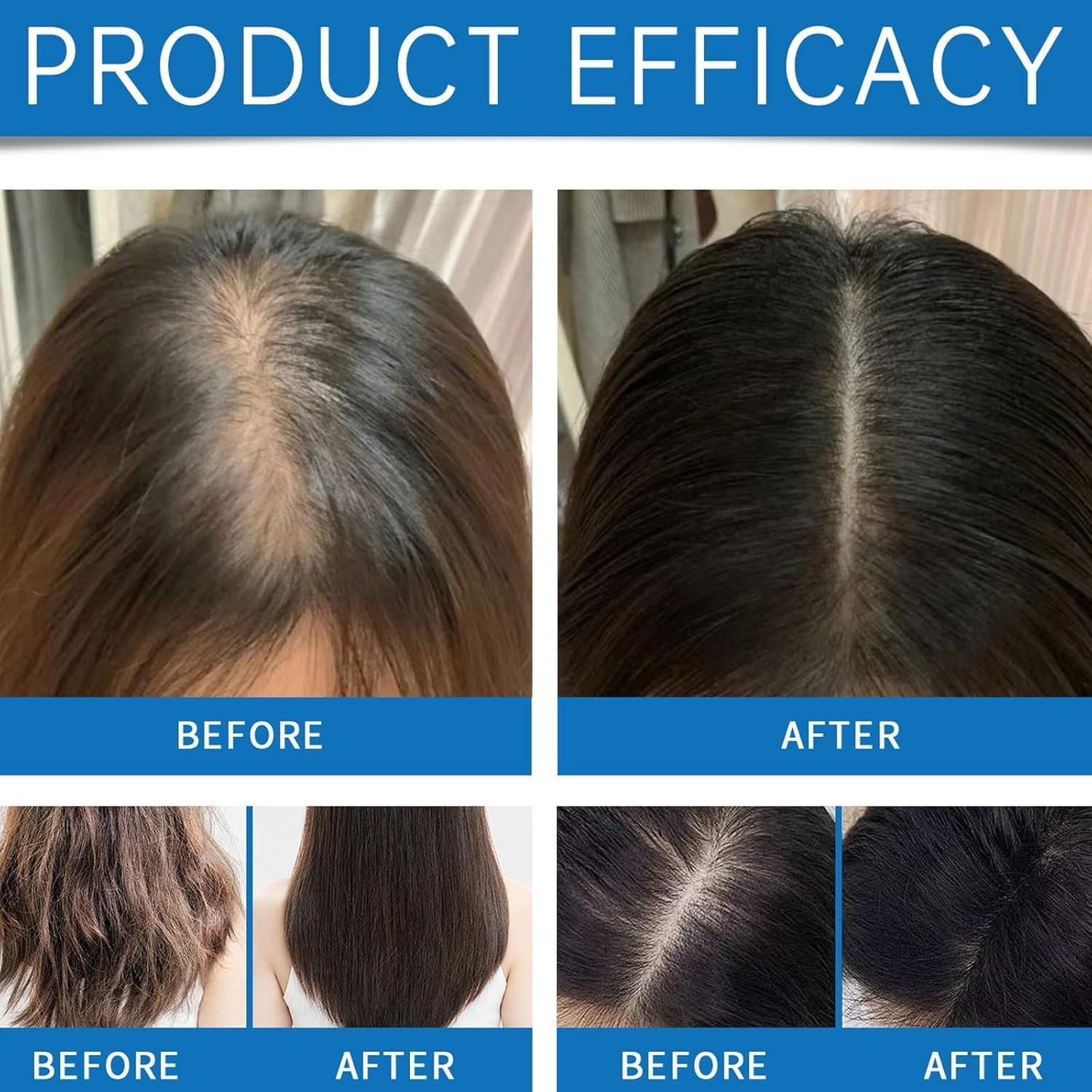 Scalp Hair Growth Serum,Scalp Hair Serum for Men & Women,2Pcs image number 3