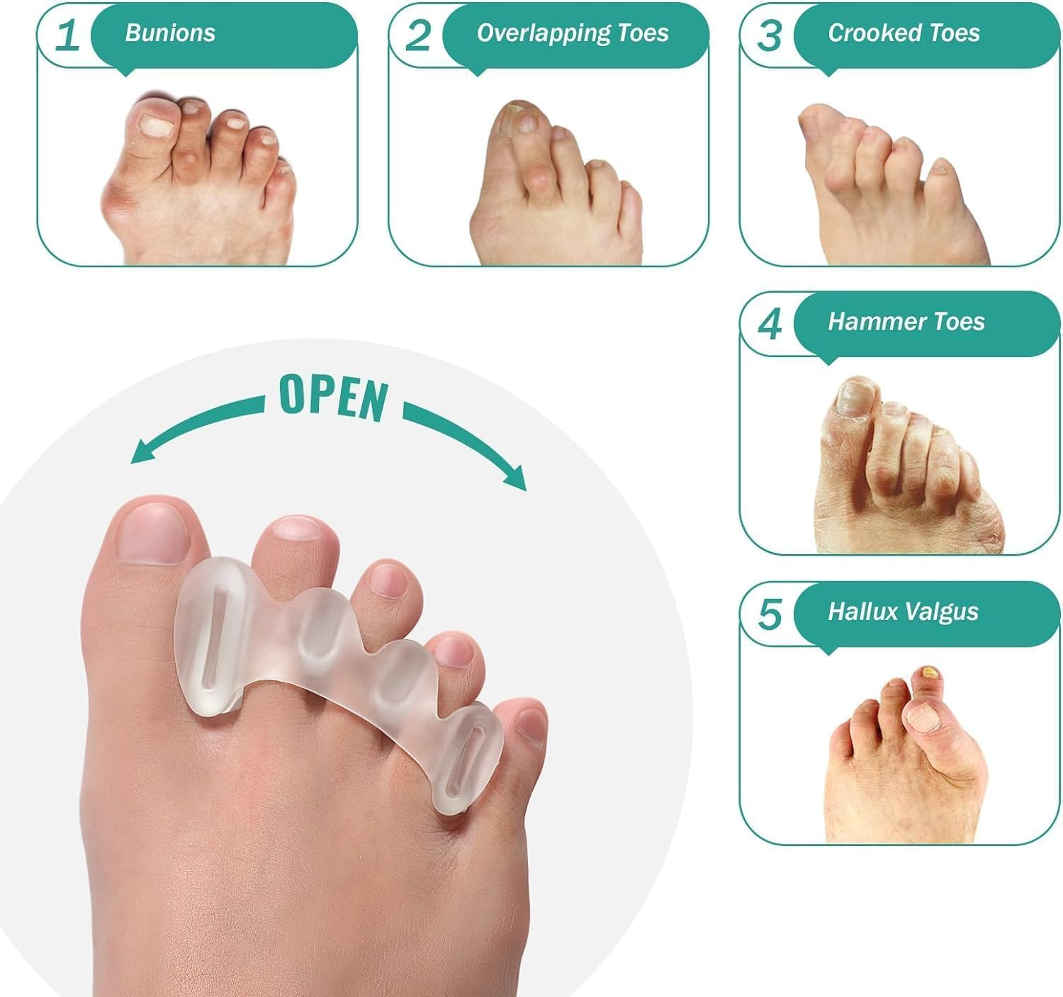 Toe Separators - Toe Spacers for Women Men, Relieve Feet Pain, Foot Alignment, Adjustable Toe Straighteners for Hammertoes (Transparent, 2 Pairs) image number 4