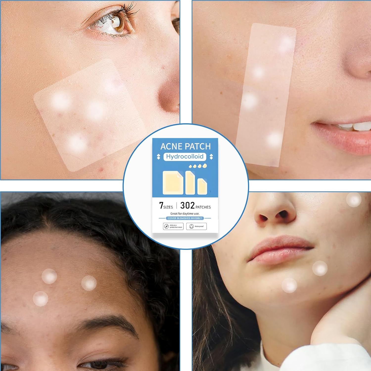 Large Pimple Patches for Face & Body, 7 Sizes Acne Hydrocolloid Bandages for Zit Breakouts, Chin, Forehead, Chest, Back, 302 Count, Effective Acne Treatment(7 Sizes 302 Count) image number 2