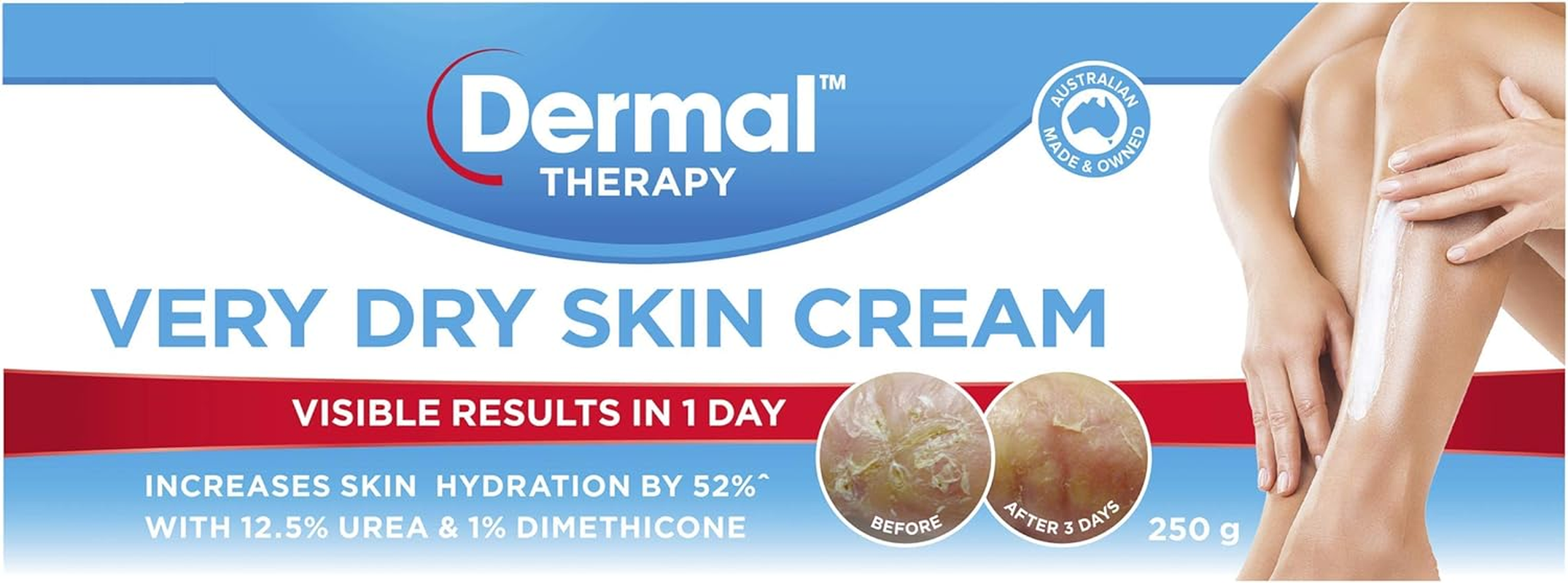 Dermal Therapy Very Dry Skin Cream for Optimum Hydration | Provides Deep Moisturisation for Severely Dry Skin on the Arms, Legs, Elbows and Back | 250G image number 2
