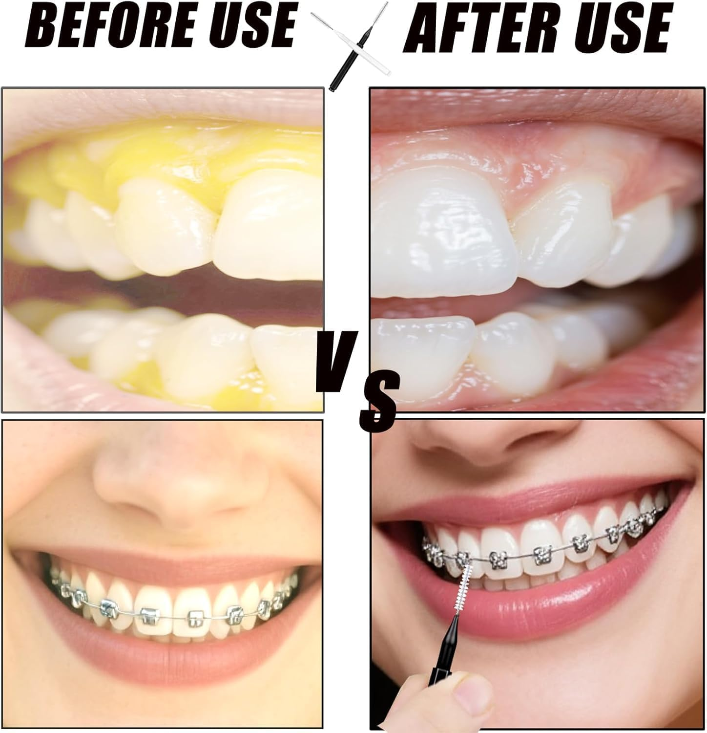 120 Pieces Interdental Brushes, Orthodontic Flossers Toothpicks for Braces, Spiral Dental Brush Head, Braces Cleaner Kit for Efficient Oral Care, Teeth Cleaning Tools, Black image number 1