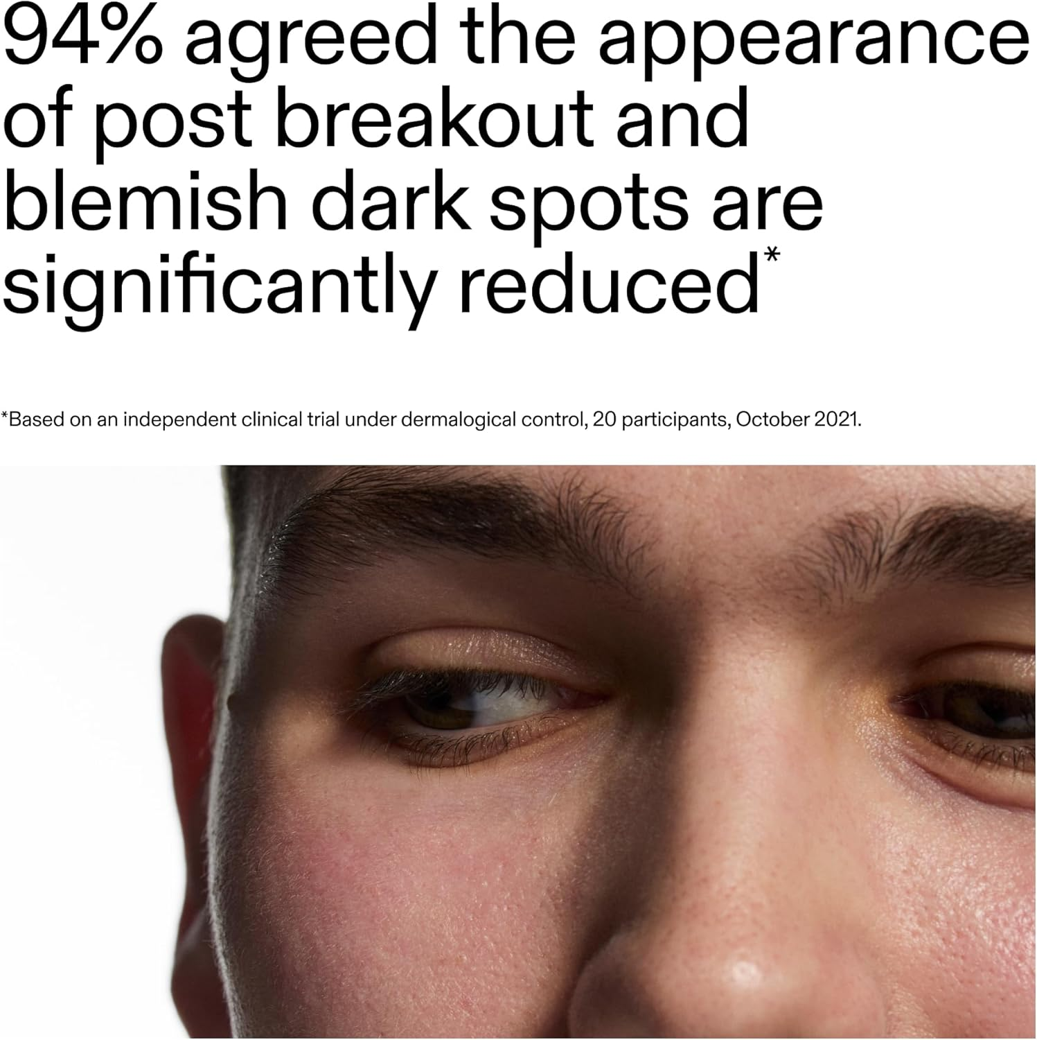 The INKEY List Mandelic Acid Treatment 15 Ml image number 6