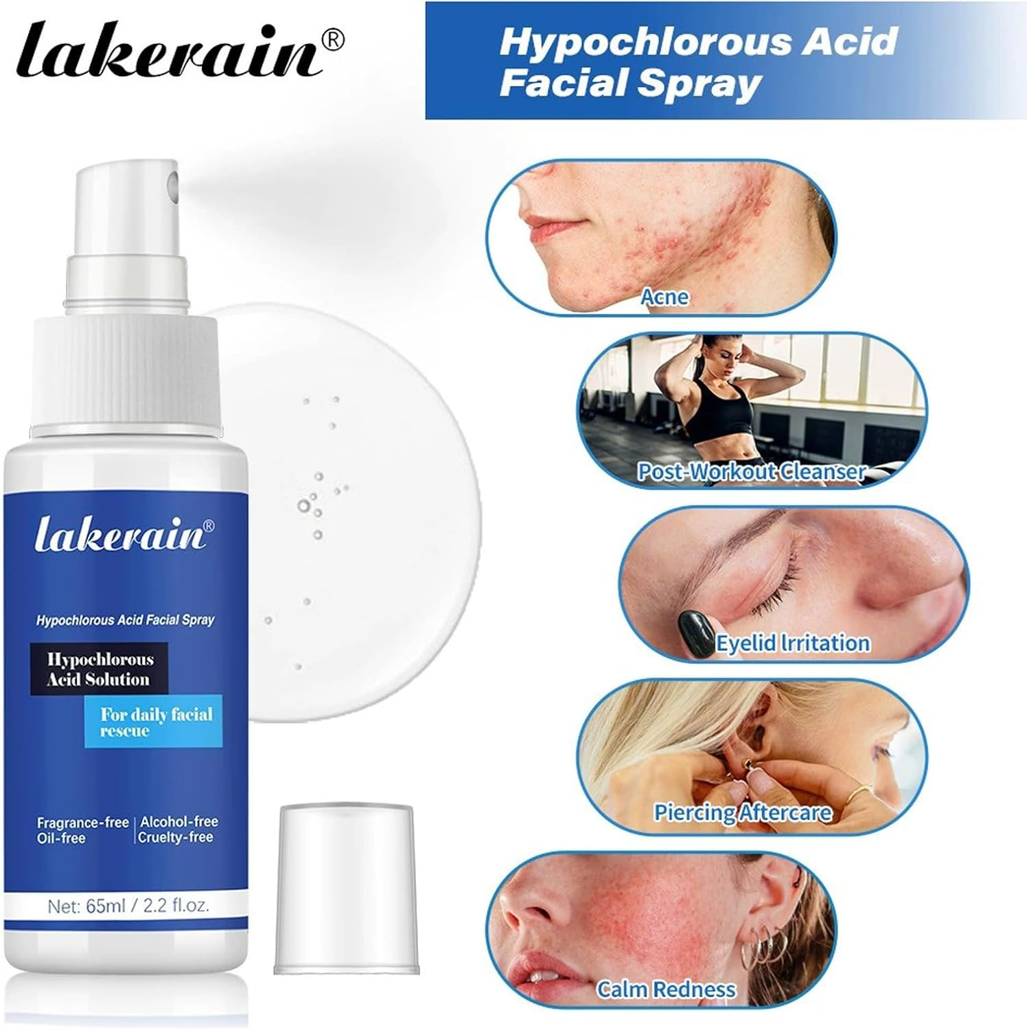 Hypochlorous Acid Spray Facial Toner, 65Ml Skin Renew Toner and Pure Hypochlorous Acid Spray Face, Moisturising for Sensitive Skin image number 4