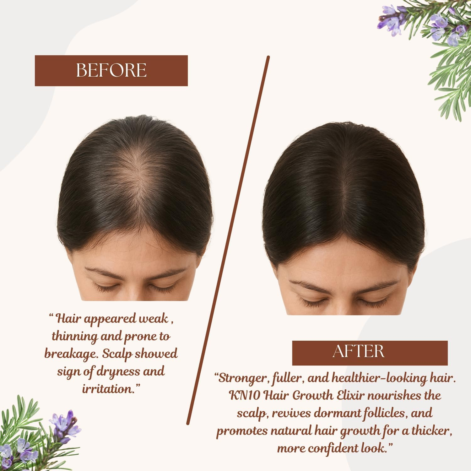 KN&rsquo;10 Hair Growth Elixir 120 Ml / 4.05 Fl. Oz - Hair Oil & Serum with Rosemary Oil for Hair Growth - Lightweight Formula Enriched with Lavender Essential Oil and Vitamin E for Fuller Strands