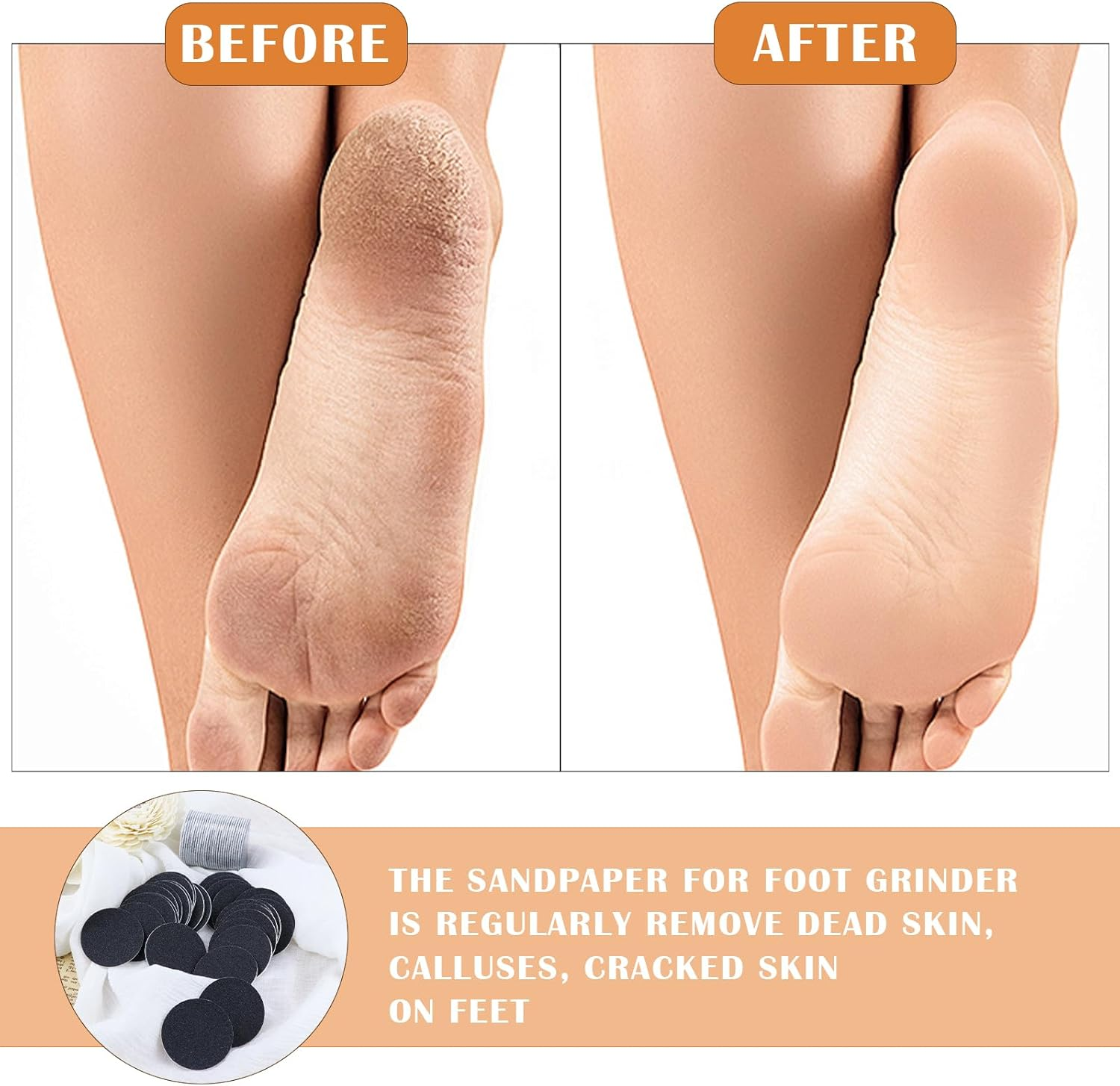 60 Pcs Electric Callus Remover Replacement Sandpaper for Hard Dead Skin, Cracked Heels, Dead Skin, Dead Skin, Dead Skin image number 1