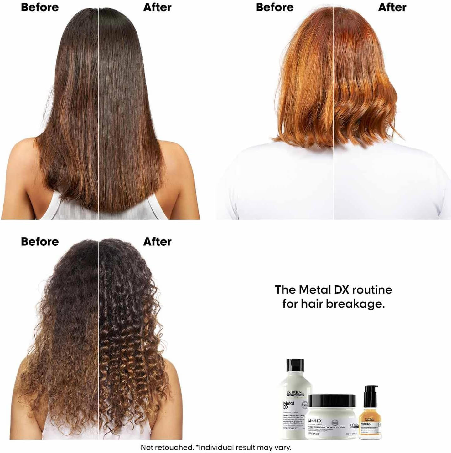 L'Or&eacute;al Professionnel Hair Shampoo for Colour Treated Hair, Radiant Colours & Shine, Series Expert, Metal DX Shampoo, 300 Ml