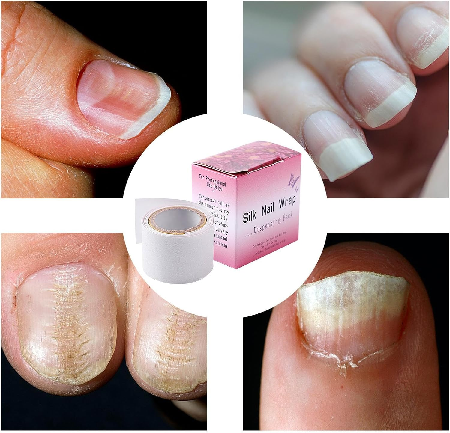 Nail Repair Stains, Mushroom Nail Treatment, Toenail Fungus Treatment, Glue Guard for UV Gel, Acrylic Extensions, Anti-Damage Wraps, Anti-Damage Toenail Wraps for Manicure