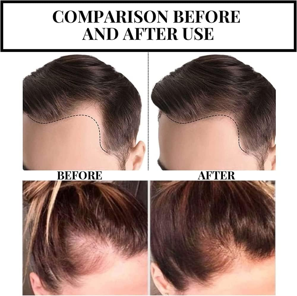 2Pcs Suna Plant Extract Hair Growth Oil,Ginger Germinal Essential Oil Hair Growth Hair Loss Treatment Hair Care Hair Growth Serum for Men & Women image number 3