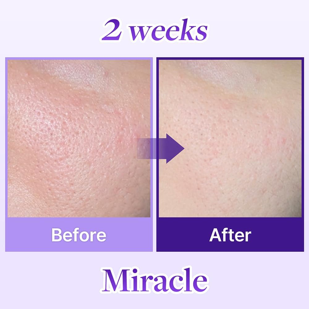 COSNORI Panthe-Shot 675 - Korean Panthenol Ampoule with 675,000 High Purity Spicules - Powerful Skin Care Solution - Intensive Facial First Essence (50Ml / 1.69 Fl. Oz.)