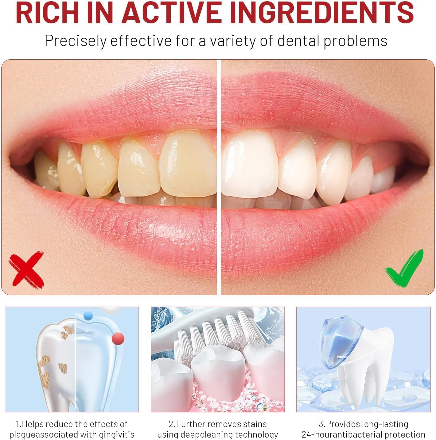 Sp10 Probiotic Toothpaste, Sp-10 Ultra Whitening Toothpaste for Fresh Breath&Stain Removal&Deep Cleaning Care,Evolved from Sp4 Sp6 image number 5