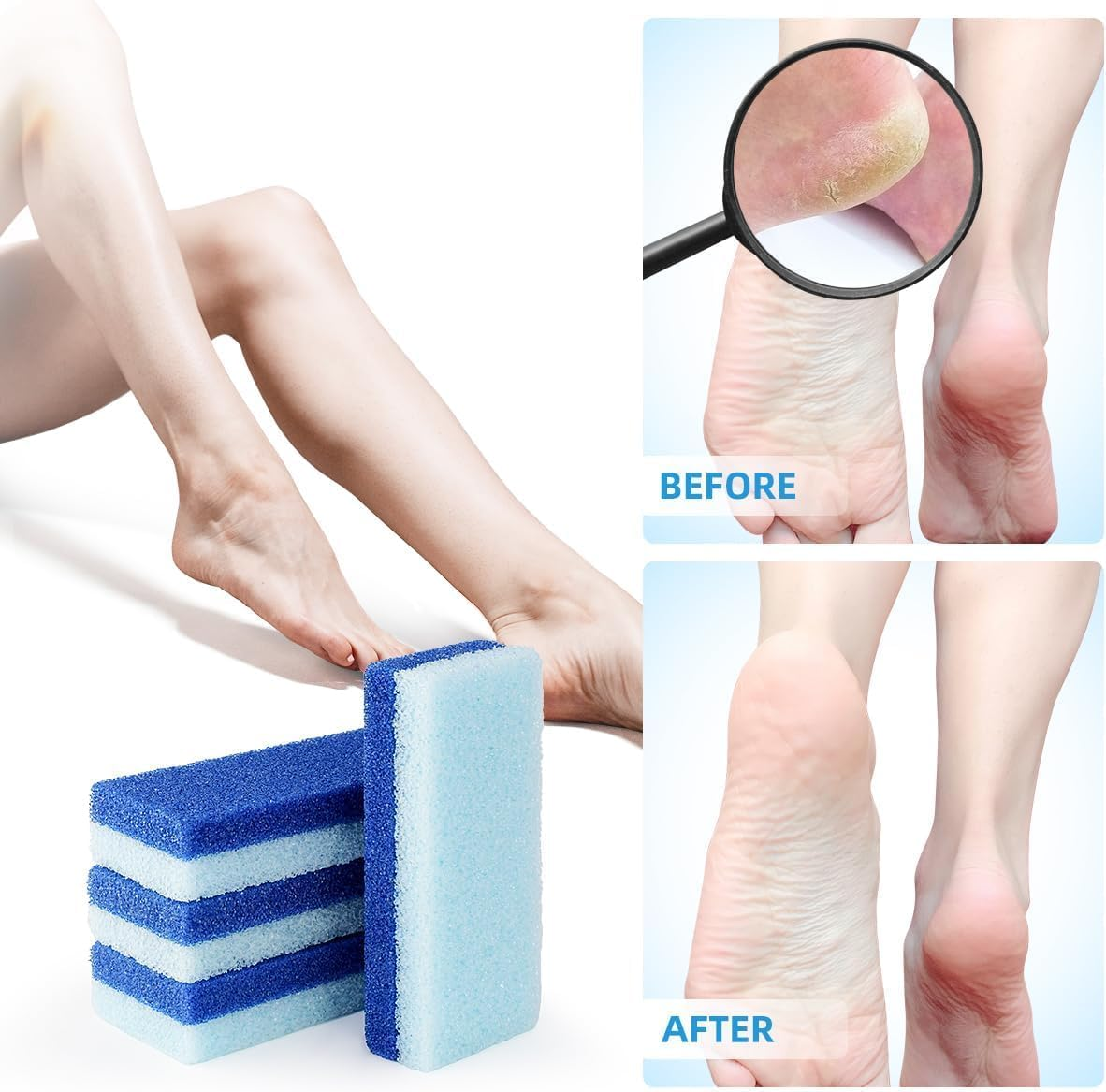 4 Pack Foot Pumice Stone, Double Sided Pumice Stone for Feet,Foot Remover and Pumice Pad, Hard Skin Callus Remover and Scrubber for Feet & Hands (Blue) - Purple image number 4