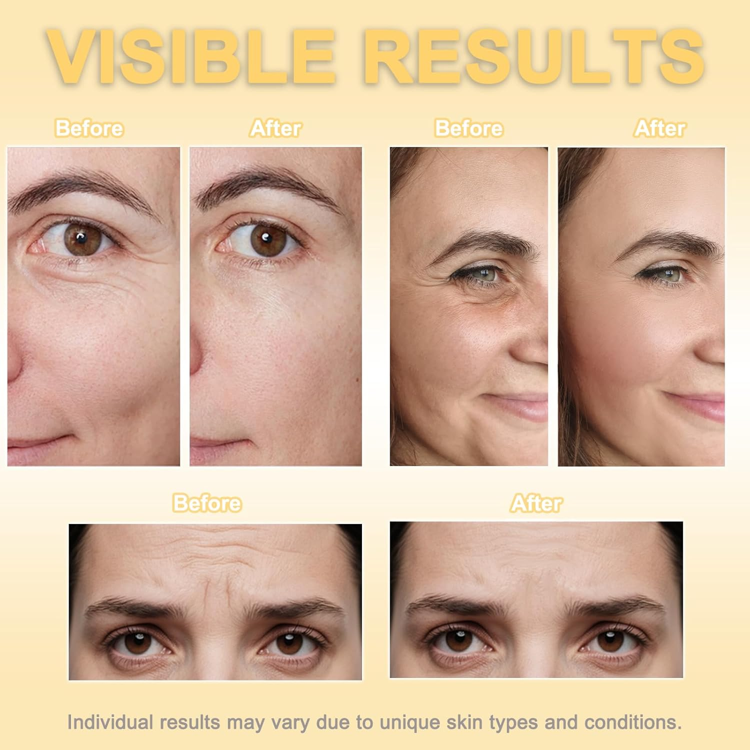 Face Tape, Kinesiology Tape for Face, Facial Myofascial Lift Tape, anti Wrinkle Patches for Fine Lines, Crow'S Feet, Face Lift Tape for Toning, Firming & Tightening the Skin - 5Cm*5M