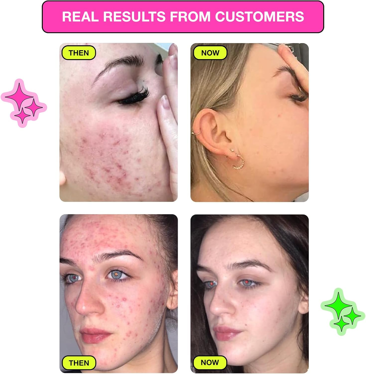 Carbon Theory | Tea Tree Oil & Citric Acid Breakout Control Facial Purifying Tonic with Pink Grapefruit | Natural, Vegan and Cruelty Free | 250Ml image number 1