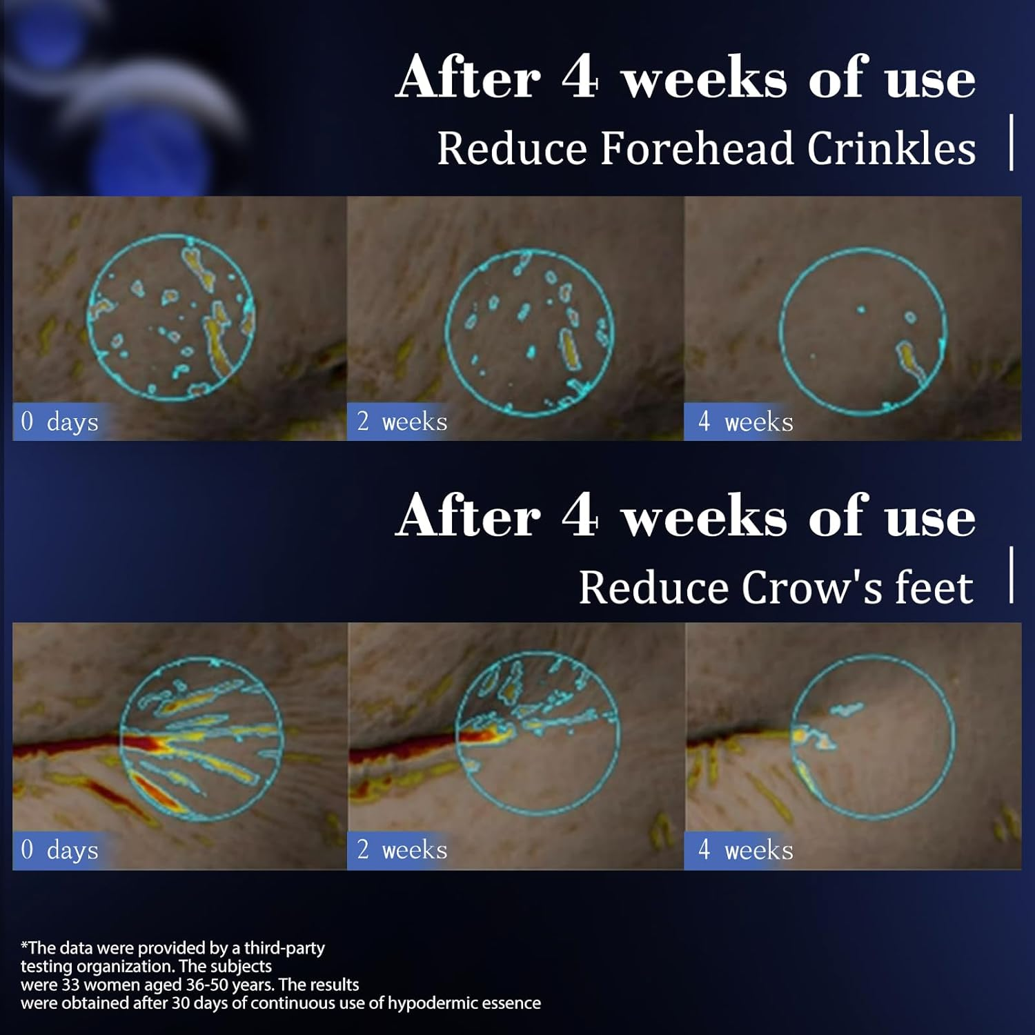 KISSIO Super Peptid Serum Ampoule,Face Serum with Copper Tripeptides,Collagen and Peptides,Hydration and Elasticity,Rejuvenating Facial Serum for Fine Lines and Wrinkles,Makeup Base,30 Ampoule image number 5