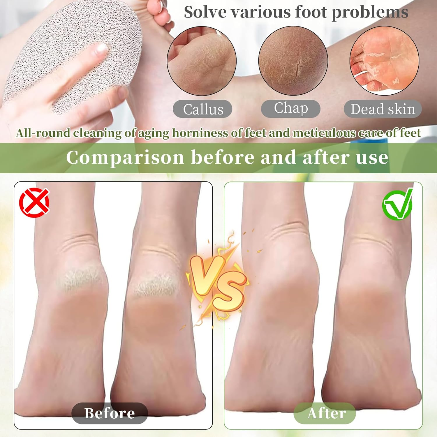 Natural Lava Pumice Stone for Feet - Premium Pedicure Tool for Hard Skin, Callus, & Dead Skin Removal - Exfoliating Foot & Hand Scrubber for Smooth Soft Skin - Callus Remover for Men & Women (4PCS) image number 4