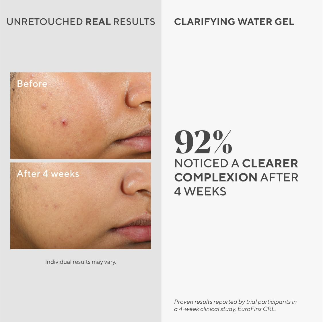 Murad Clarifying Water Gel - Oil-Free Face Moisturiser 60 Ml, Lightweight Hydrating Water-Gel with Salicylic & Hyaluronic Acid for Blemish-Prone, Oily & Combination Skin image number 1