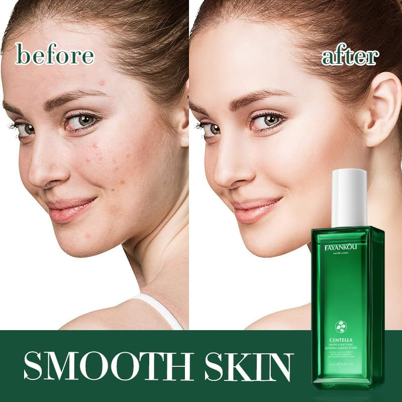 Centella Asiatica Soothing Repairing Essence Toner, 125Ml image number 4