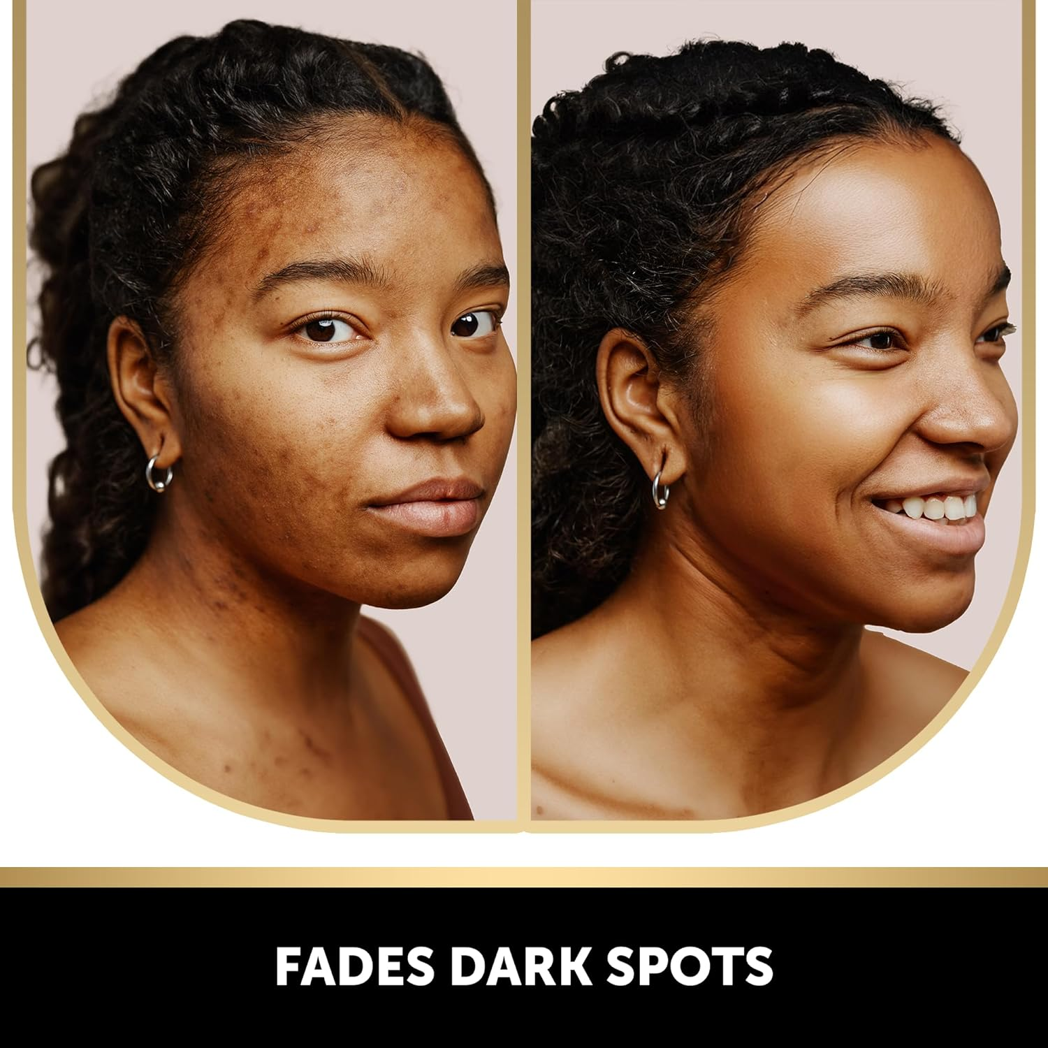 VALITIC Kojic Acid Vitamin C and Retinol Soap Bars with Turmeric for Dark Spot - Original Japanese Complex with Collagen, Hyaluronic Acid, Vitamin E (2-Pack) - with Soap Holder image number 2