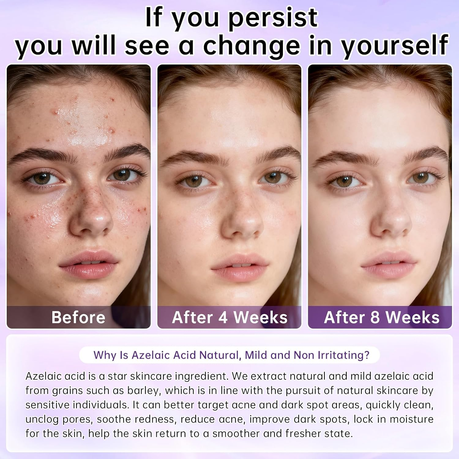 12% Azelaic Acid Cream with Niacinamide & Hyaluronic Acid, Face Moisturizer for Dark Spots, Acne, Redness & Pore Care, Azelaic Acid Serum for Sensitive Skin, Balances Oil, 20 G image number 3