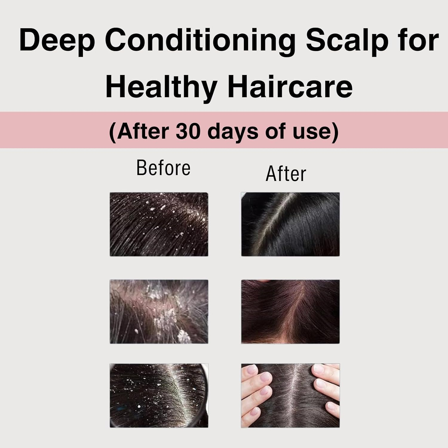 Moist Diane Perfect Beauty Extra Vital Treatment, Sulfate-Free, with Organic Argan Oil & Vitalizing Keratin from Japan, Rejuvenate Silky Smooth Hair Hair Care, for Men and Women, 15.2 Fl Oz/450 Ml image number 5