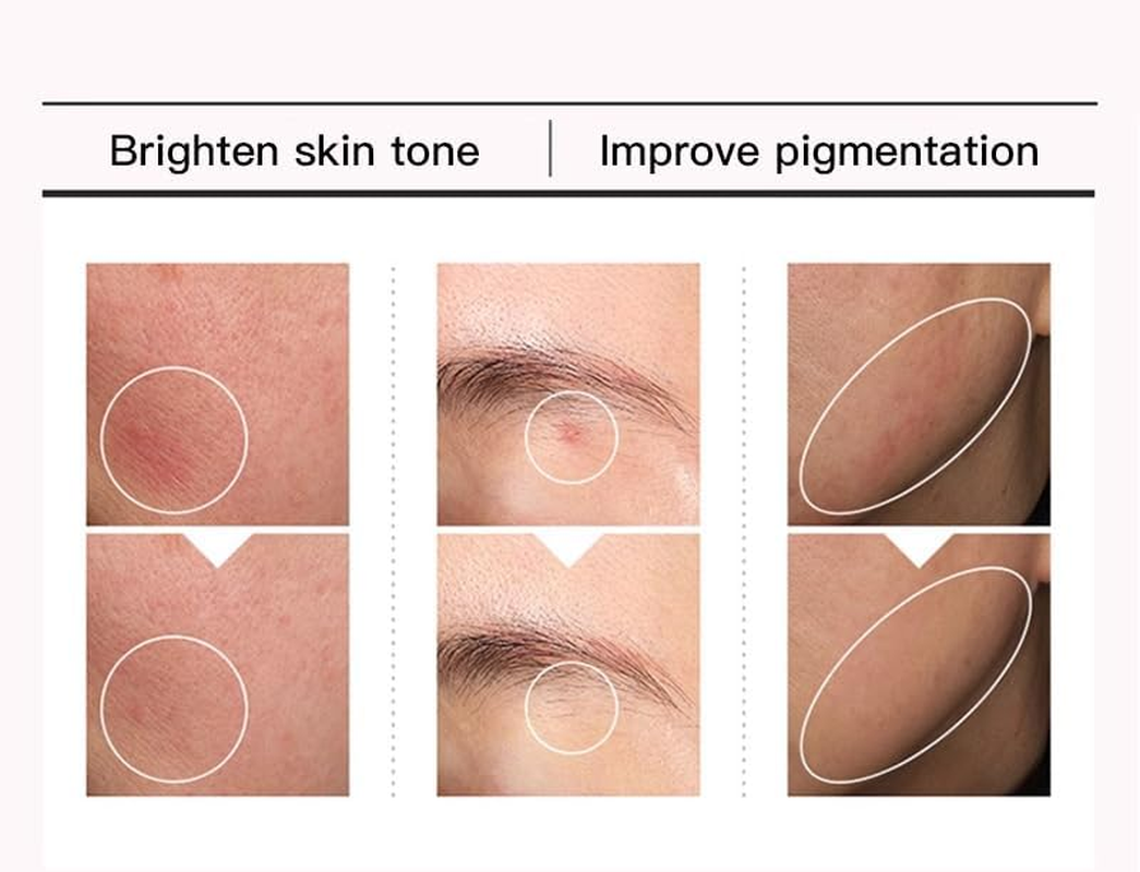 Niacinamide Serum &ndash; 10% Niacinamide + 4% Tranexamic Acid,Dark Spot Correcting Serum|Brightening & Skin Regeneration, Safe & Lightweight, Suitable for All Skin Types, Daily Use,30Ml/1.01 Fl.Oz