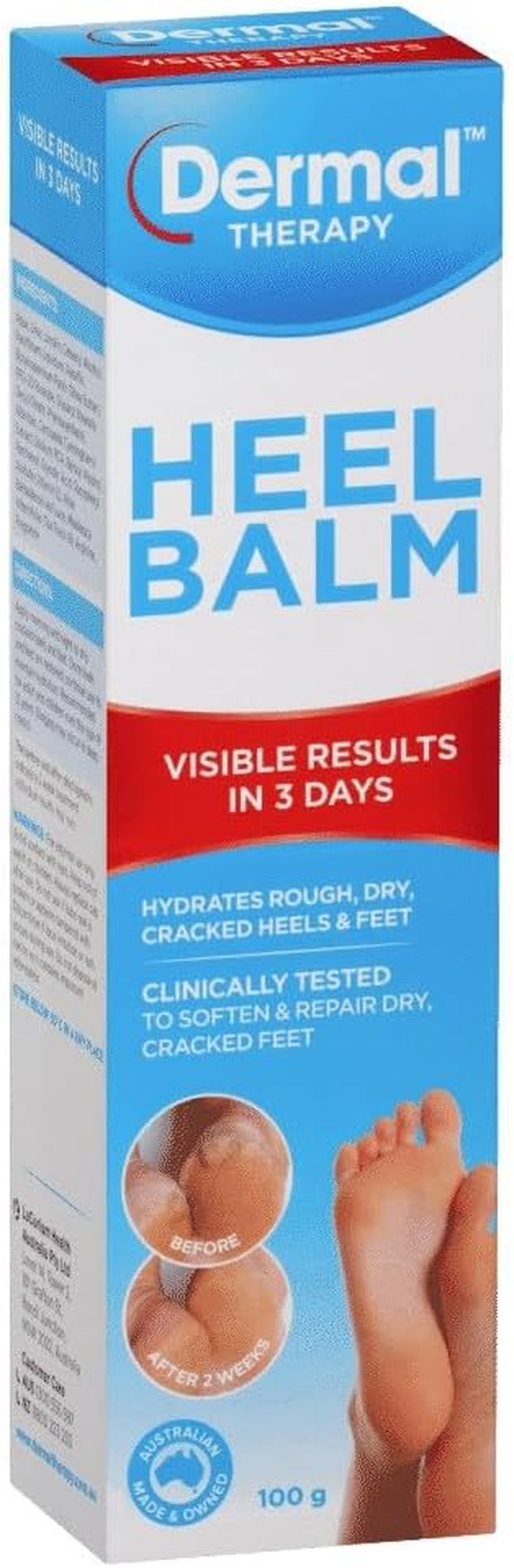 Dermal Therapy Heel Balm | Hydrates Rough, Dry, Cracked Heels and Feet | 100G