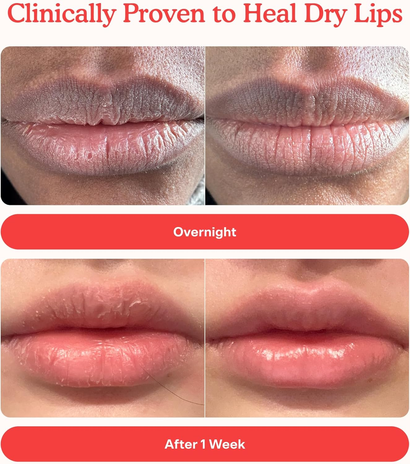 Lip Softie Moisturizing Lip Balm (Grape & Vanilla)