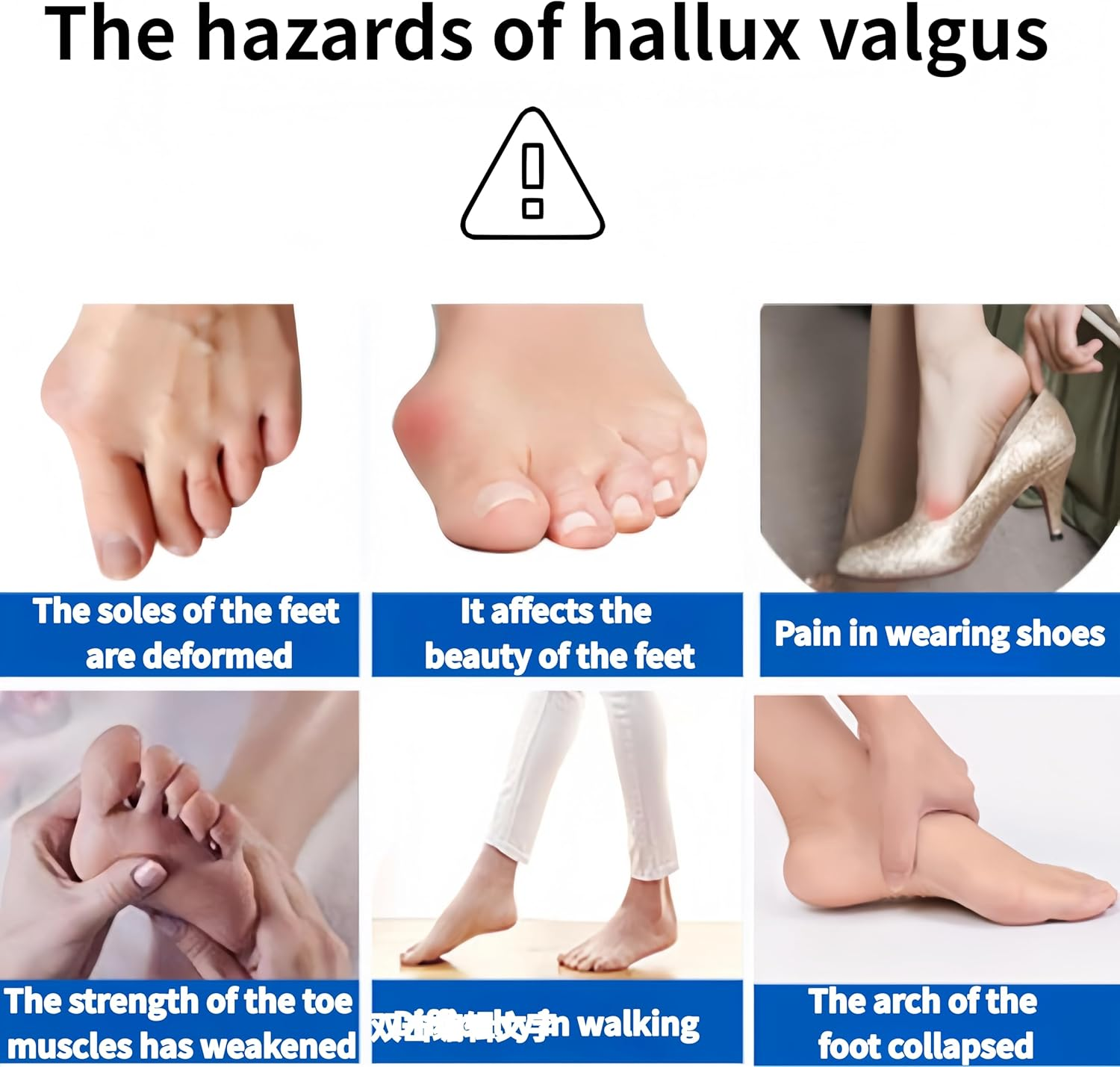 Linjhokbs 2 Pairs Toe Spacers，Correct Bunions and Restore Toes to Their Original Shape/Bunion Corrector Toe Spacer Toe Straightener Toe Stretcher Big Toe Correctors for Women and Men，Skin-Color image number 5