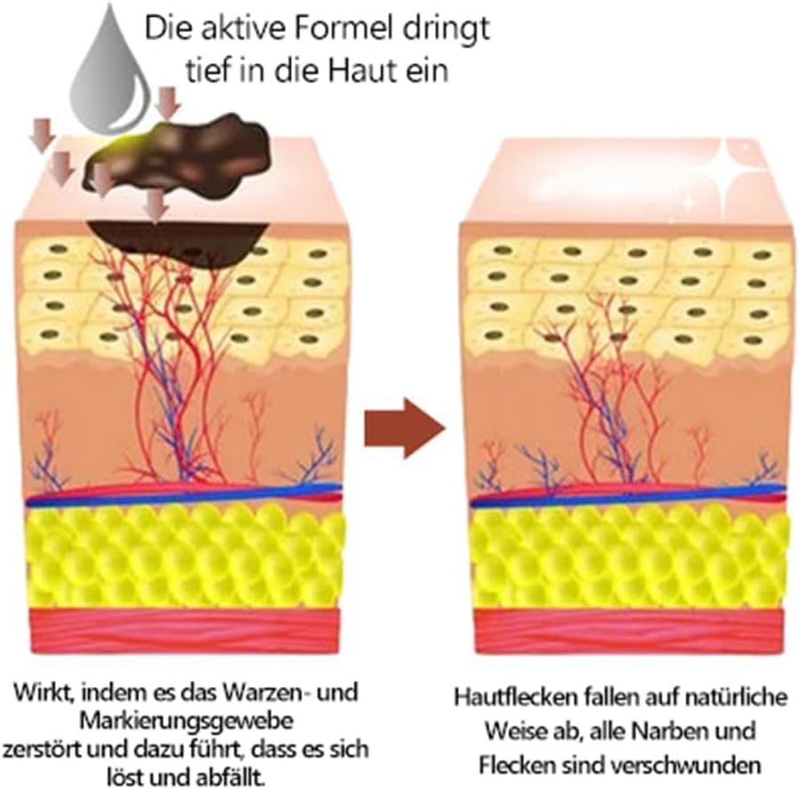 Zmbdz Lenaro Bee Venom Repair Cream Hydrating Moisturizing Cream Remove Spots for Women All Skin 2Pcs image number 2