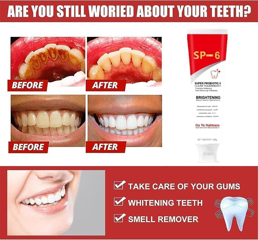 2Pcs Ms Drwikey Probiotics Bright White Toothpaste,Sp-6 Ultra Whitening Toothpaste,Probiotic Brightening Toothpaste,Deep Cleaning Care Toothpaste,Fresh Breath