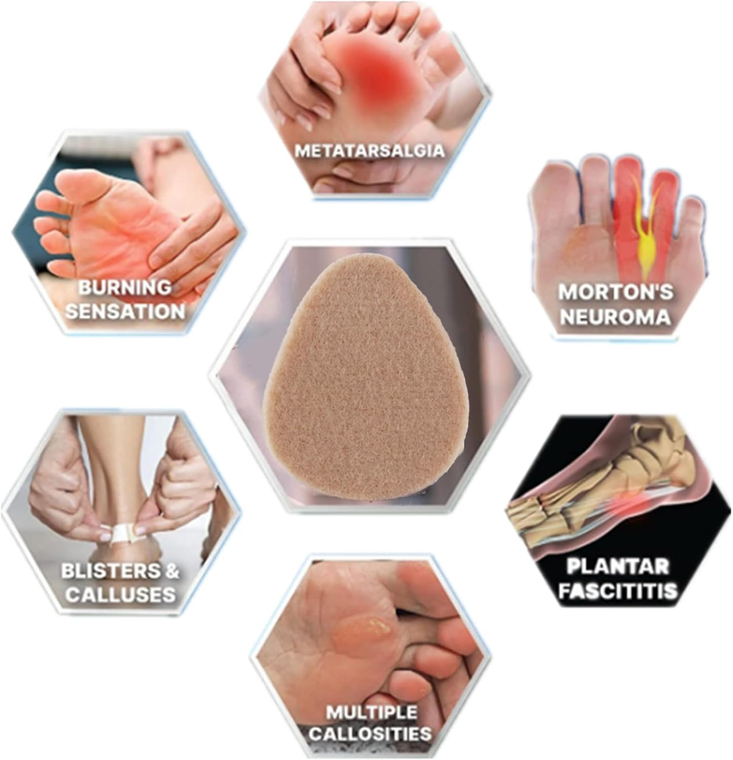 20 Pieces Felt Metatarsal Pads for Men and Women, Forefoot Pads, Forefoot Pads, Bunion Pads, Foot Pads for Metatarsalgia and Morton'S Neuroma image number 4