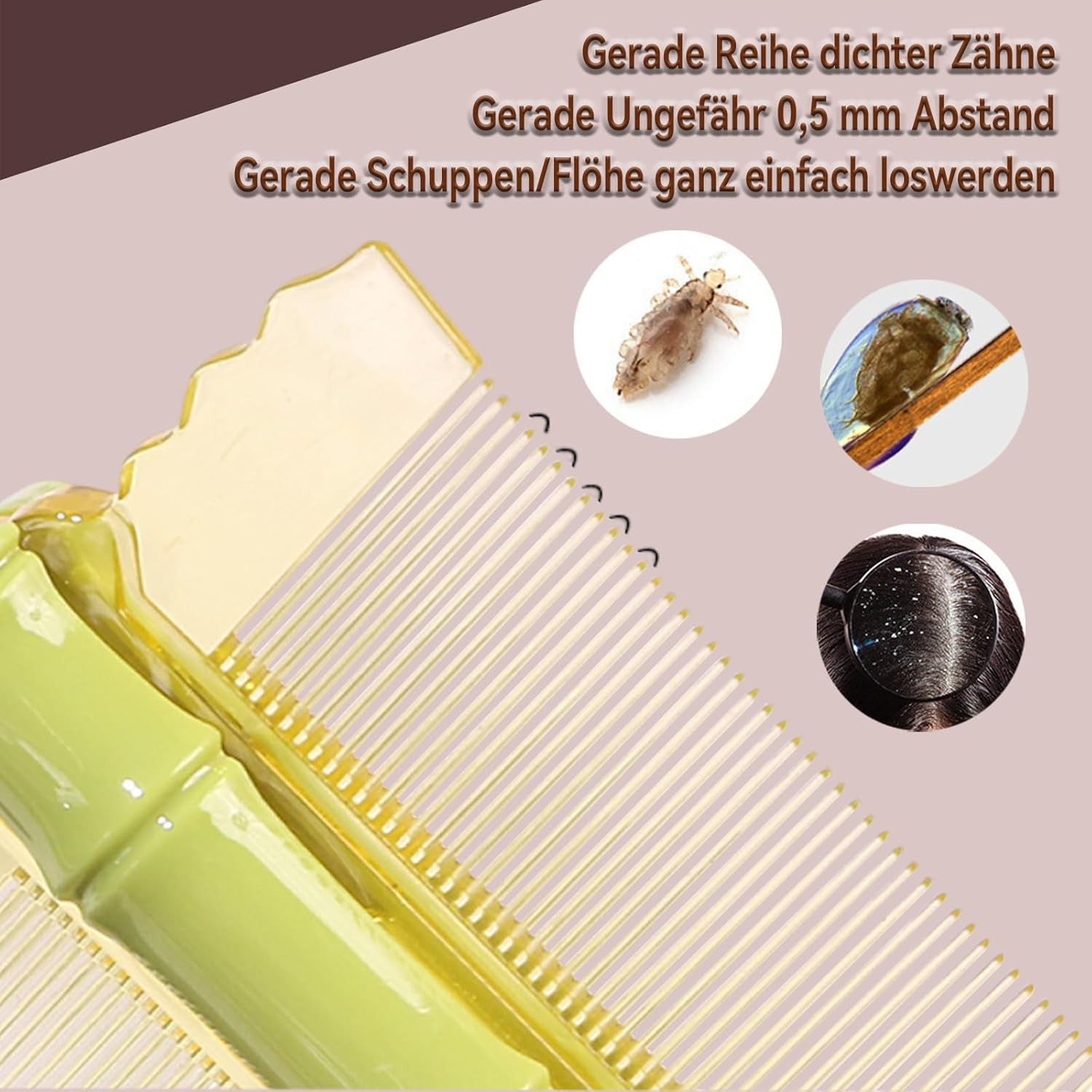 Whaleo 2 Pieces Lice and Nits Comb Lice Comb Lice Comb Hair Comb Narrow Teeth Eliminates Lice and Nits Durable and Easy to Clean image number 2